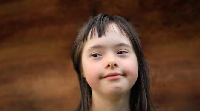 Hari Down Syndrome Sedunia