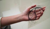 rambut rontok saat menopause