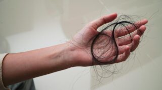 rambut rontok saat menopause